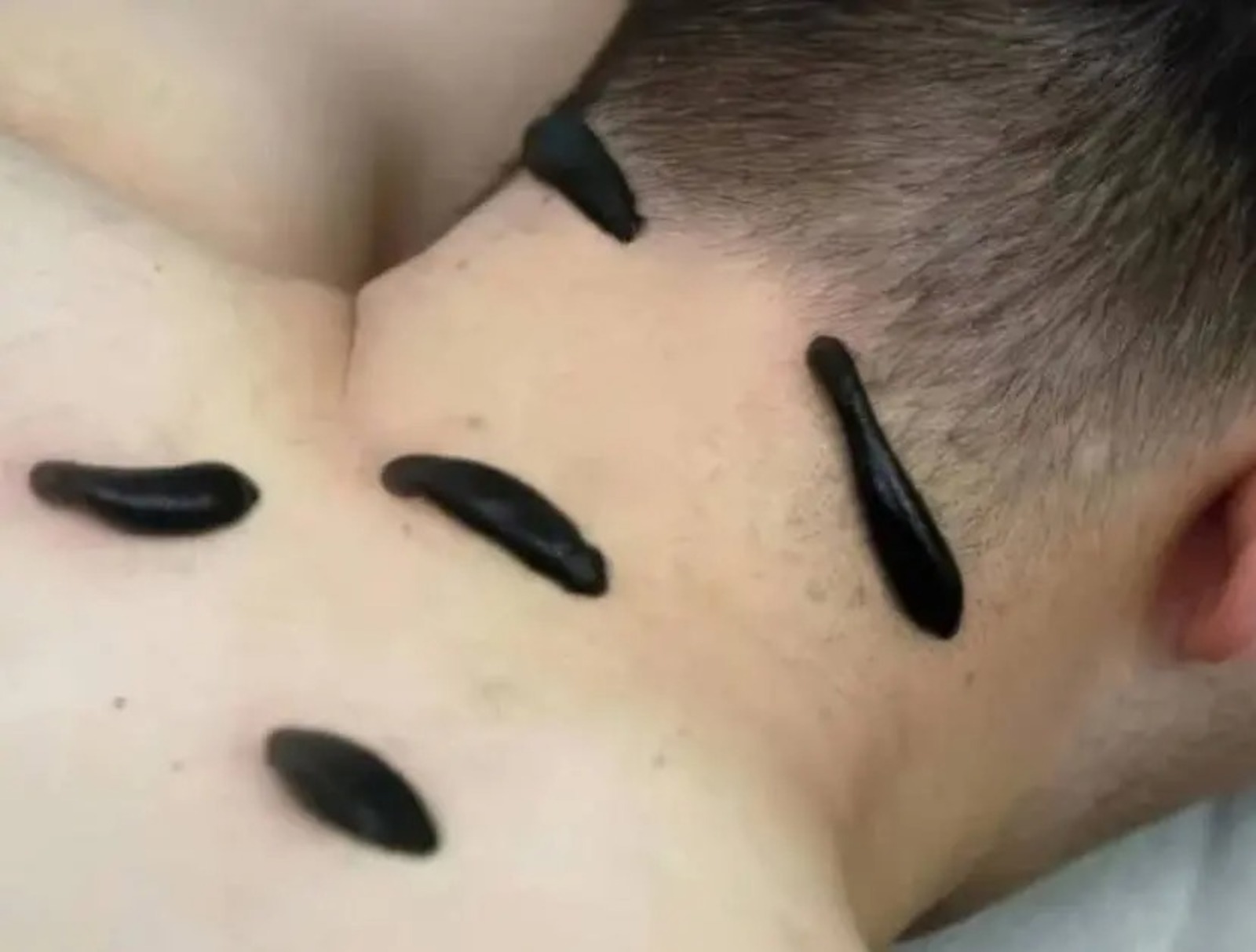 Сөлек салу файдалымы?