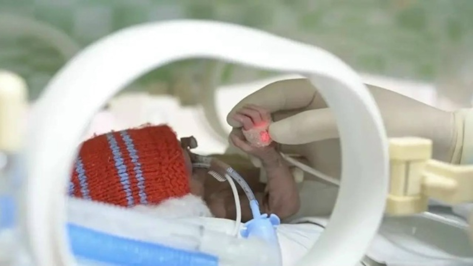 24нче атнада туган 480 грамм авырлыктагы сабыйны коткарганнар