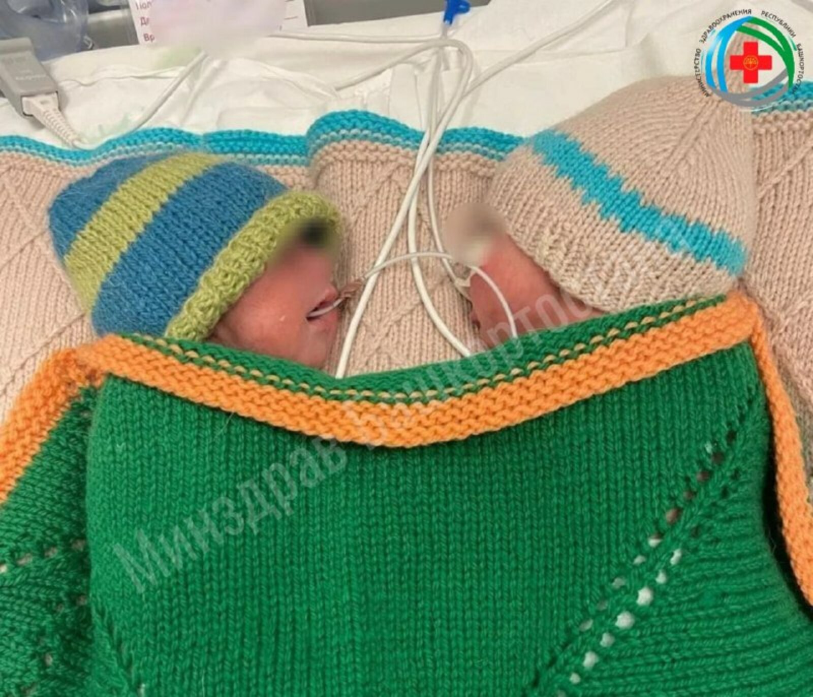 Уфа табиблары  яңа туган игезәкләрне коткарган