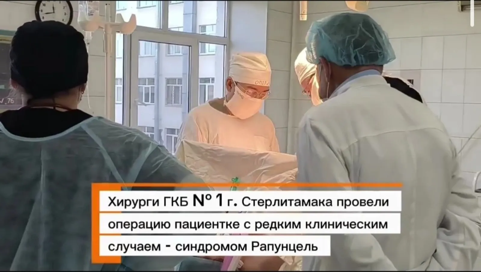 Бер хатынның ашказаныннан 25 сантиметрлы чәч төене алганнар