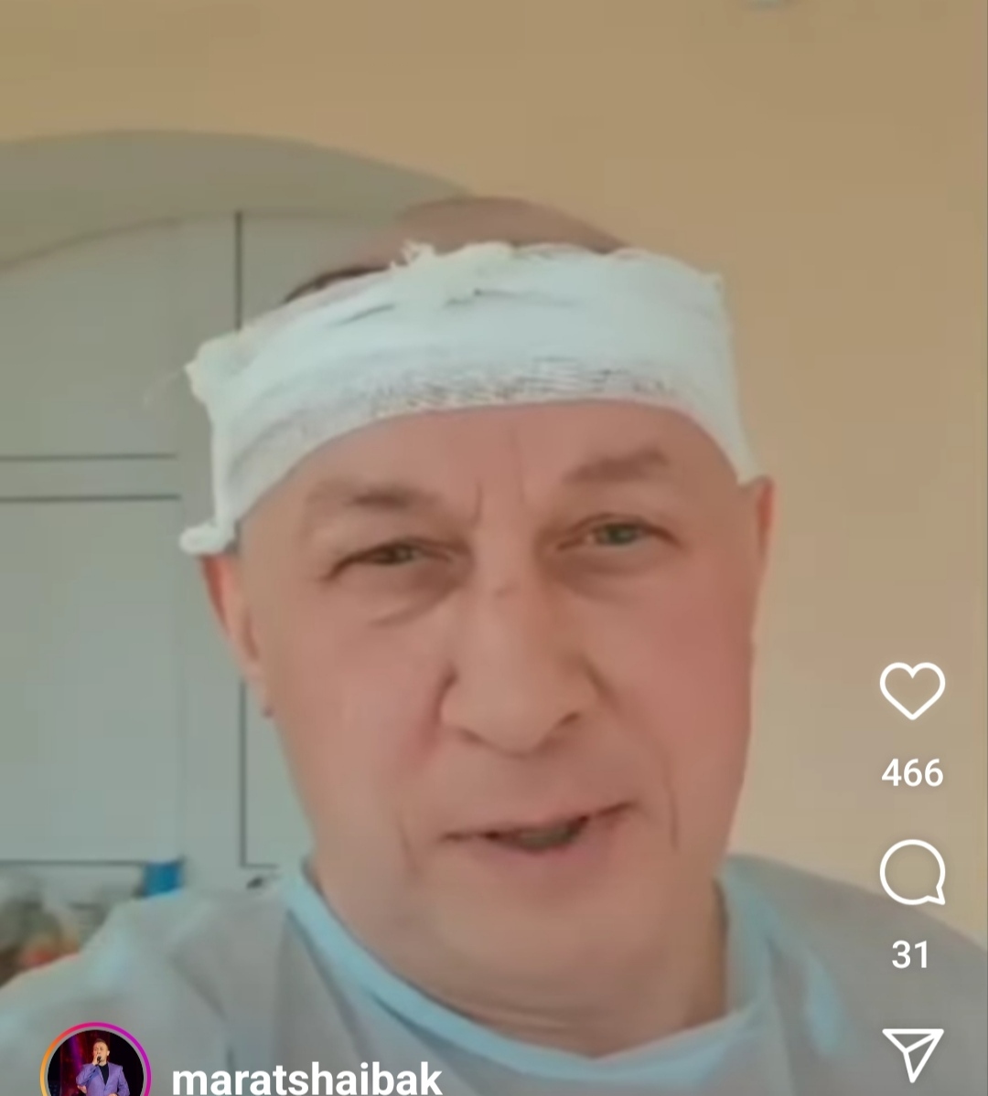 Марат Шәйбәков чәч күчереп утырту буенча операция ясаткан