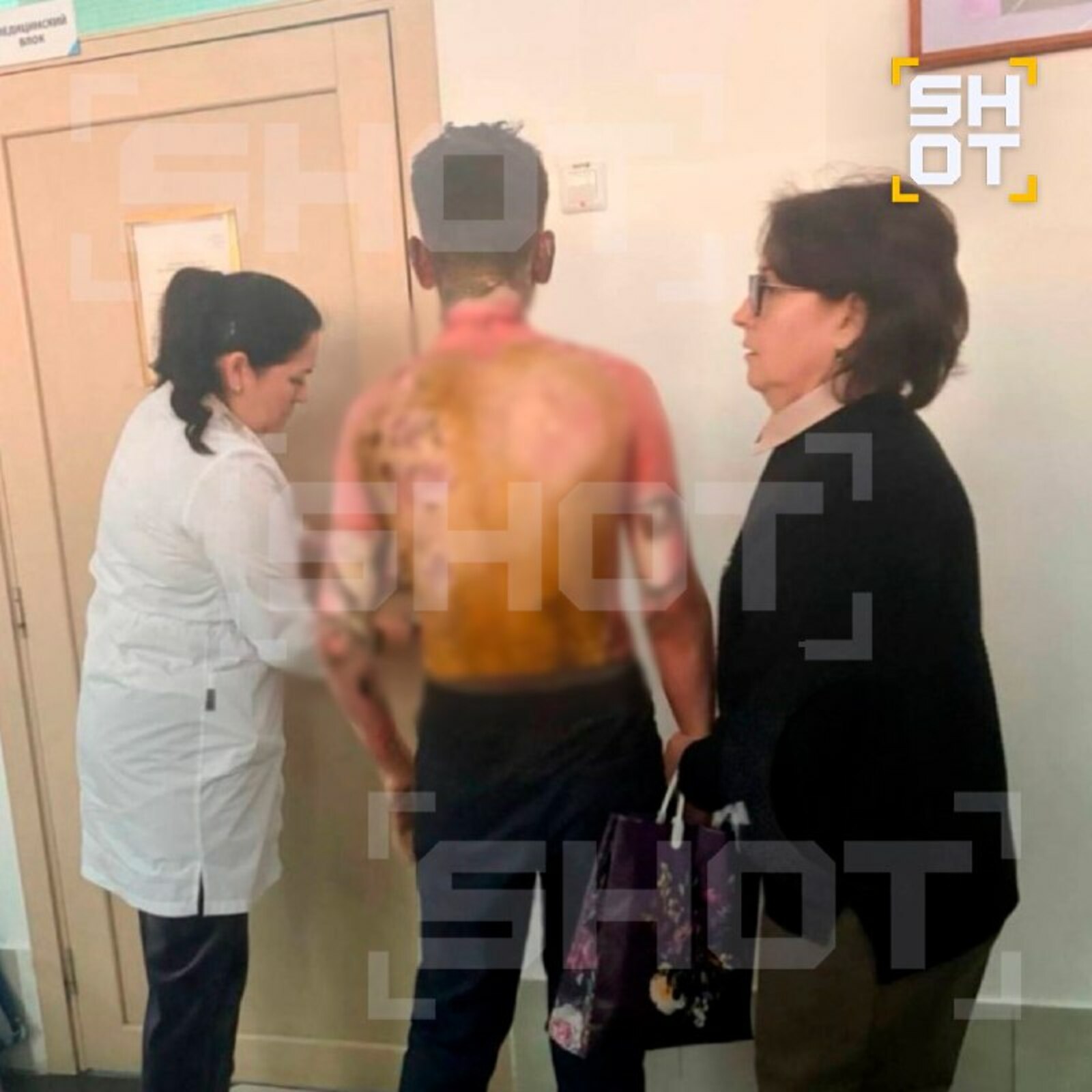 Шок: 8нче сыйныф укучысы яшьтәшләренә ут төрткән. Кыз авыр хәлдә