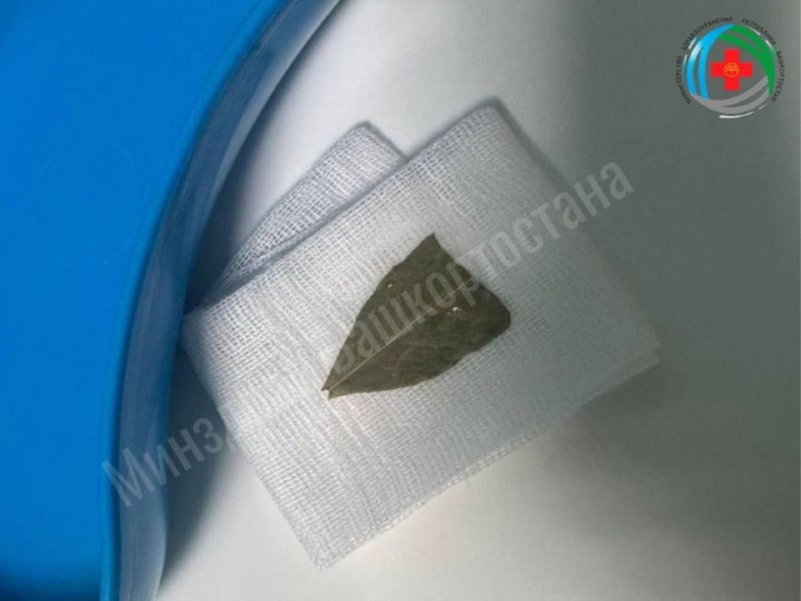 Дәфнә яфрагы сулыш юлын каплаган