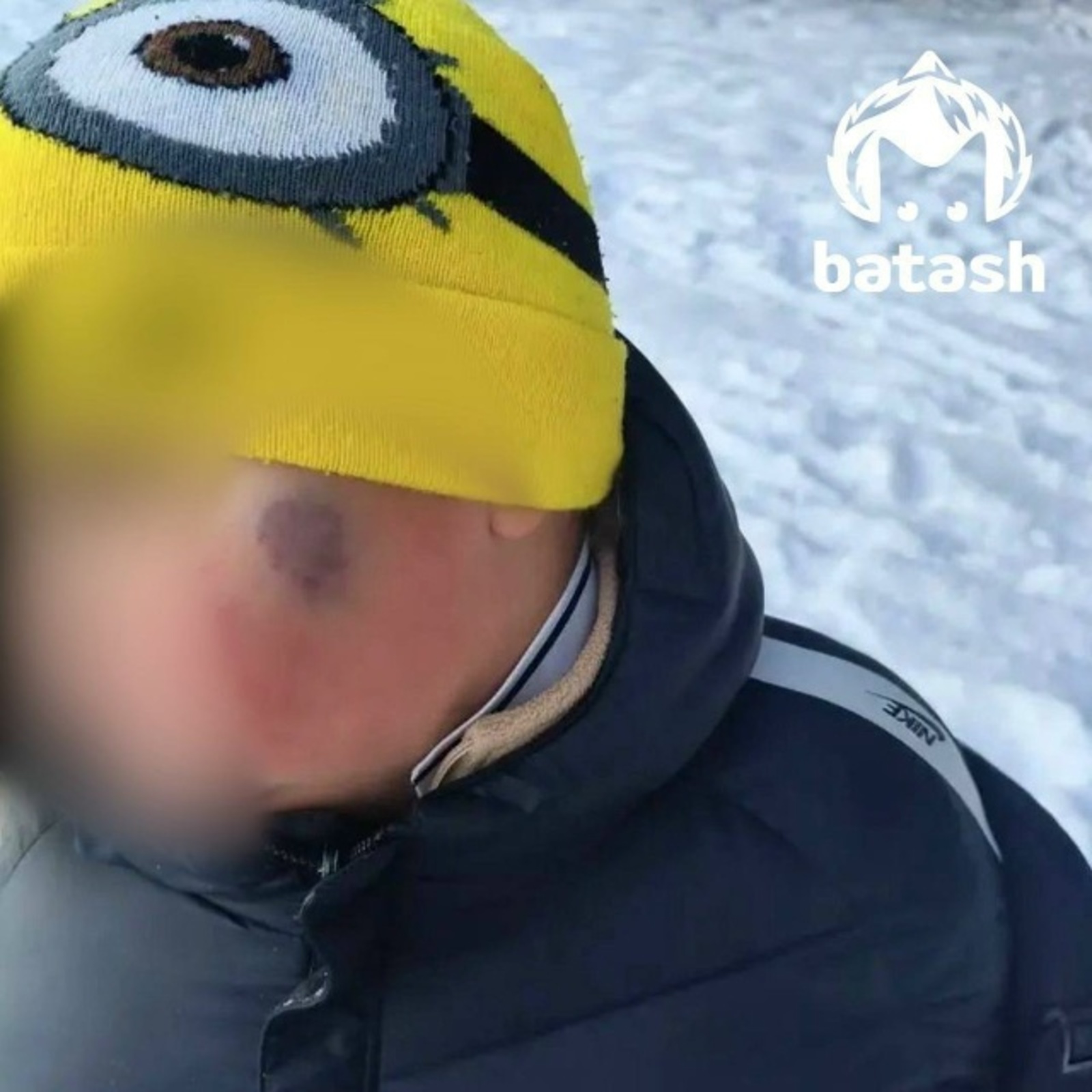 Икенче сыйныф укучысын сыйныфташы кыйнаган