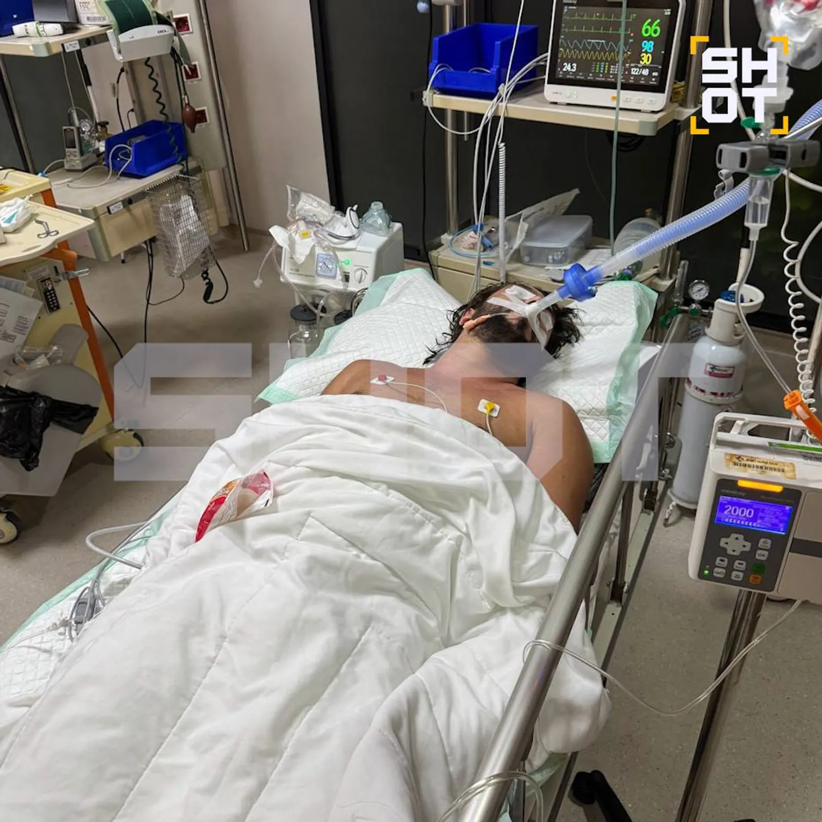 Русияле Бали утравында суррогат алкоголь эчеп үлгән